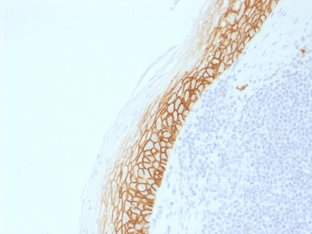 IHC testing of FFPE human tonsil with recombinant CD44v9 antibody (clone CD44v9/2344R). Required HIER: boil tissue sections in pH 9 10mM Tris with 1mM EDTA for 10-20 min followed by cooling at RT for 20 min.~