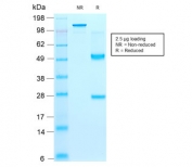 SDS-PAGE analysis of purified, BSA-free recombinant CD44v9 antibody (clone rCD44v9/1459) as confirmation of integrity and purity.