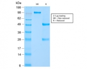 SDS-PAGE analysis of purified, BSA-free recombinant HSP60 antibody (clone HSPD1/2206R) as confirmation of integrity and purity.