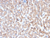 IHC testing of FFPE human liver tissue with recombinant HSP60 antibody (clone HSPD1/2206R). HIER: boil tissue sections in 10mM citrate buffer, pH6, for 10-20 min followed by cooling at RT for 20 min.