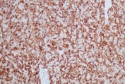 IHC testing of FFPE dog pancreas tissue with recombinant HSP60 antibody (clone HSPD1/2206R). HIER: boil tissue sections in 10mM citrate buffer, pH6, for 10-20 min followed by cooling at RT for 20 min.