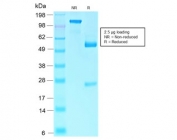 SDS-PAGE analysis of purified, BSA-free recombinant RB1 antibody (clone RB1/2313R) as confirmation of integrity and purity.