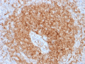 IHC testing of FFPE human spleen with recombinant CD79a antibody (clone rIGA/764). Required HIER: boil tissue sections in pH 9 10mM Tris with 1mM EDTA for 10-20 min followed by cooling at RT for 20 min.~