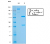 SDS-PAGE analysis of purified, BSA-free recombinant CD79a antibody (clone rIGA/764) as confirmation of integrity and purity.