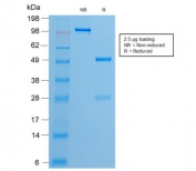 SDS-PAGE analysis of purified, BSA-free recombinant Estrogen Receptor antibody (clone ESR1/2299R) as confirmation of integrity and purity.