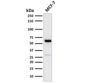 Western blot testing of human MCF7 cell lysate with recombinant Estrogen Receptor antibody (clone ESR1/2299R). Predicted molecular weight ~67 kDa.