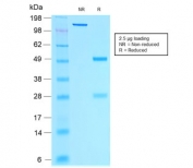SDS-PAGE analysis of purified, BSA-free recombinant Estrogen Receptor alpha antibody (clone rESR1/1935) as confirmation of integrity and purity.