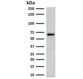 Western blot testing of MCF7 cell lysate with recombinant Estrogen Receptor alpha antibody. Predicted molecular weight ~66 kDa.~