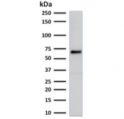 Western blot testing of MCF7 cell lysate with recombinant Estrogen Receptor alpha antibody. Predicted molecular weight ~66 kDa.