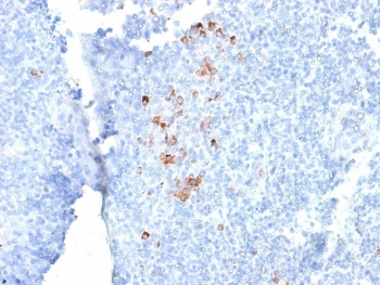 IHC testing of FFPE human tonsil with recombinant human IgG antibody (clone rIG266). Required HIER: boil tissue sections in 10mM citrate buffer, pH 6, for 10-20 min followed by cooling at RT for 20 min.~