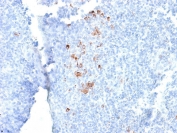 IHC testing of FFPE human tonsil with recombinant human IgG antibody (clone rIG266). Required HIER: boil tissue sections in 10mM citrate buffer, pH 6, for 10-20 min followed by cooling at RT for 20 min.