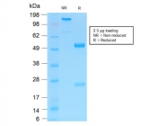 SDS-PAGE analysis of purified, BSA-free recombinant p75NTR antibody (clone NGFR/1997R) as confirmation of integrity and purity.