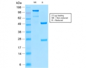 SDS-PAGE analysis of purified, BSA-free recombinant TRP1 antibody (clone TYRP1/2340R) as confirmation of integrity and purity.