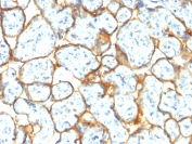 IHC testing of FFPE human placental tissue with recombinant Insulin Receptor alpha antibody (clone INSR/2277R). Required HIER: boil tissue sections in pH6, 10mM citrate buffer, for 10-20 min followed by cooling at RT for 20 min.