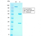 SDS-PAGE analysis of purified, BSA-free recombinant Cadherin 16 antibody (clone rCDH16/1071) as confirmation of integrity and purity.