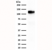 Western blot testing of human kidney lysate with recombinant Cadherin 16 antibody (clone rCDH16/1071).