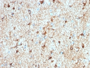 IHC testing of FFPE human cerebellum tissue with recombinant GFAP antibody (clone ASTRO/1974R). Required HIER: boil tissue sections in pH 9 10mM Tris with 1mM EDTA for 10-20 min followed by cooling at RT for 20 min.