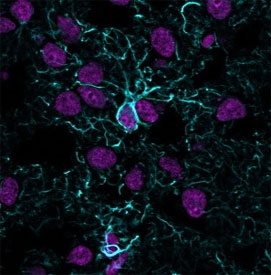 Immunofluorescent staining of frozen human cerebral cortex tissue with recombinant GFAP antibody (blue, clone ASTRO/1974R) and Histone H1 antibody (magenta, clone HH1/957).~