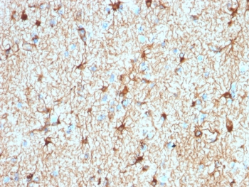 IHC testing of FFPE human cerebellum tissue with recombinant GFAP antibody (clone ASTRO/1974R). Required HIER: boil tissue sections in pH 9 10mM Tris with 1mM EDTA for 10-20 min followed by cooling at RT for 20 min.~