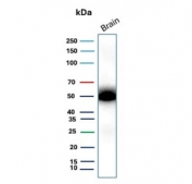 Western blot testing of human brain tissue with recombinant GFAP antibody. Predicted molecular weight ~50 kDa.