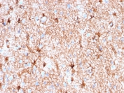 IHC testing of FFPE human cerebellum tissue with recombinant Glial Fibrillary Acidic Protein antibody (clone rASTRO/789). Required HIER: boil tissue sections in pH 9 10mM Tris with 1mM EDTA for 10-20 min followed by cooling at RT for 20 min.