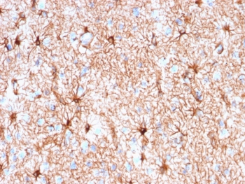 IHC testing of FFPE human cerebellum tissue with recombinant Glial Fibrillary Acidic Protein antibody (clone rASTRO/789). Required HIER: boil tissue sections in pH 9 10mM Tris with 1mM EDTA for 10-20 min followed by cooling at RT for 20 min.~