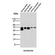 GFAP Antibody Brain Tissue WB. Western blot analysis of human brain, mouse brain, rat brain, guinea pig brain, and hamster brain tissue lysates using recombinant Glial fibrillary acidic protein Antibody clone rASTRO/789. Strong bands are detected at approximately 50 kDa across multiple mammalian brain samples, consistent with the predicted molecular weight of GFAP, a major astrocytic intermediate filament protein involved in maintenance of neural cytoskeletal organization and central nervous system architecture. The observed cross-species reactivity pattern is consistent with the highly conserved expression of GFAP within glial cell populations of the mammalian brain.