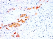 IHC testing of FFPE human bladder with recombinant CD44v4 antibody (clone rCD44v4/1219). Required HIER: steam sections in pH 9 10mM Tris with 1mM EDTA buffer for 10-20 min.