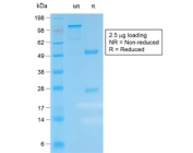 SDS-PAGE analysis of purified, BSA-free recombinant anti-Kappa antibody (clone IGKC/1999R) as confirmation of integrity and purity.