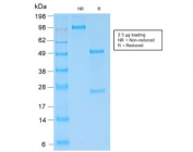 SDS-PAGE analysis of purified, BSA-free recombinant Kappa antibody (clone KLC2289R) as confirmation of integrity and purity.