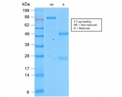SDS-PAGE analysis of purified, BSA-free recombinant Involucrin antibody (clone IVRN/2113R) as confirmation of integrity and purity.