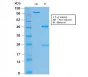 SDS-PAGE analysis of purified, BSA-free recombinant CEA antibody (clone rC66/1009) as confirmation of integrity and purity.