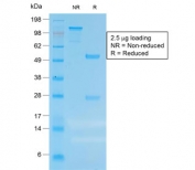 SDS-PAGE analysis of purified, BSA-free recombinant CEA antibody (clone C66/1983R) as confirmation of integrity and purity.
