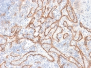 IHC testing of FFPE human tonsil tissue with recombinant b-Catenin antibody (clone CTNNB1/2030R). Required HIER: boil tissue sections in 10mM citrate buffer, pH 6, for 10-20 min followed by cooling at RT for 20 min.