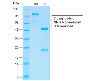 SDS-PAGE analysis of purified, BSA-free recombinant b-Catenin antibody (clone CTNNB1/2030R) as confirmation of integrity and purity.