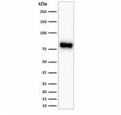 Western blot testing of human HeLa antibody with recombinant b-Catenin antibody (clone CTNNB1/2030R). Predicted molecular weight ~85 kDa, but routinely observed at 90-95 kDa.