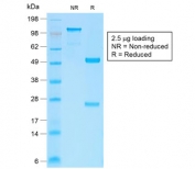 SDS-PAGE analysis of purified, BSA-free recombinant b-Catenin antibody (clone CTNNB1/2030R) as confirmation of integrity and purity.