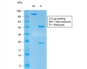 SDS-PAGE analysis of purified, BSA-free recombinant Keratin 10 antibody (clone rKRT10/1275) as confirmation of integrity and purity.