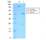 SDS-PAGE analysis of purified, BSA-free recombinant HCG-beta antibody (clone HCGb/1996R) as confirmation of integrity and purity.