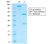 SDS-PAGE analysis of purified, BSA-free recombinant HCG-beta antibody (clone HCGb/1985R) as confirmation of integrity and purity.