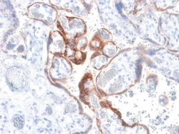 IHC testing of FFPE human placenta with HCG-beta antibody (clone HCGb/1985R). Required HIER: boil tissue sections in 10mM citrate buffer, pH 6, for 10-20 min followed by cooling at RT for 20 min.~