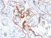 IHC testing of FFPE human placenta with HCG-beta antibody (clone HCGb/1985R). Required HIER: boil tissue sections in 10mM citrate buffer, pH 6, for 10-20 min followed by cooling at RT for 20 min.