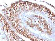 IHC testing of FFPE rat testis with recombinant WT1 antibody (clone rWT1/857). Required HIER: boil tissue sections in pH 9 10mM Tris with 1mM EDTA for 10-20 min followed by cooling at RT for 20 min.