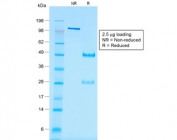 SDS-PAGE analysis of purified, BSA-free recombinant WT1 antibody (clone rWT1/857) as confirmation of integrity and purity.