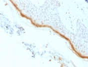IHC testing of FFPE human skin with recombinant Filaggrin antibody (clone rFLG/1561). Required HIER: boil tissue sections in 10mM citrate buffer, pH 6, for 10-20 min followed by cooling at RT for 20 min.
