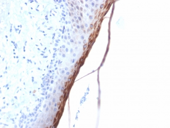 IHC testing of FFPE human skin with recombinant FLG antibody (clone FLG/1957R). Required HIER: boil tissue sections in 10mM citrate buffer, pH 6, for 10-20 min followed by cooling at RT for 20 min.~