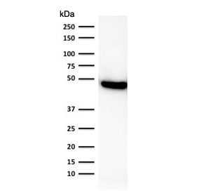 Western blot testing of human lung lysate using recombinant CK19 antibody (clone rKRT19/800). Predic