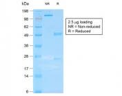 SDS-PAGE analysis of purified, BSA-free recombinant CK19 antibody (clone rKRT19/800) as confirmation of integrity and purity.