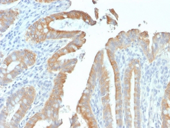 IHC testing of FFPE human colon tissue with recombinant Cytokeratin 19 antibody (clone rKRT19/799). Required HIER: boil tissue sections in pH 9 10mM Tris with 1mM EDTA for 10-20 min followed by cooling at RT for 20 min.~