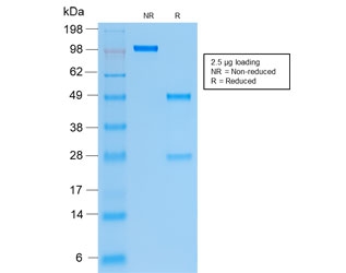 SDS-PAGE analysis of purified, BSA-free recombinant Cytokeratin 19 antibody (clone rKRT19/799) as confirmation of integrity and purity.